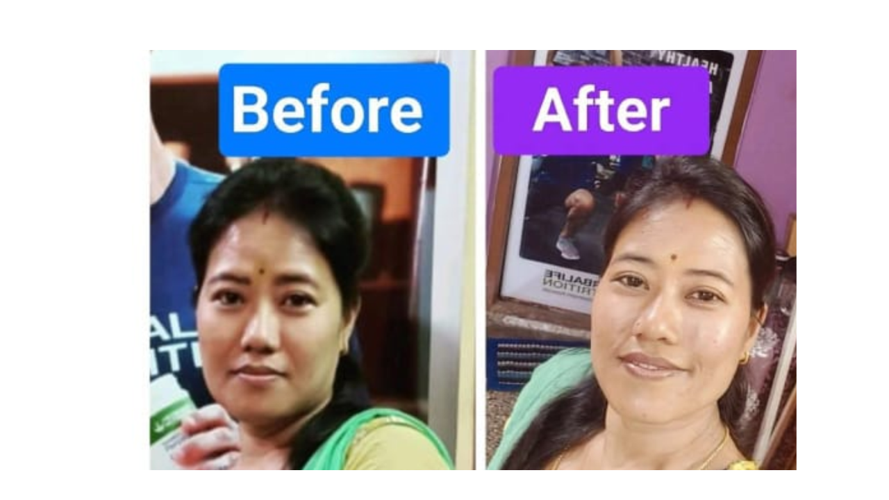 SKIN Transformation